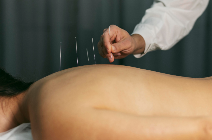 Yoga & Acupuncture